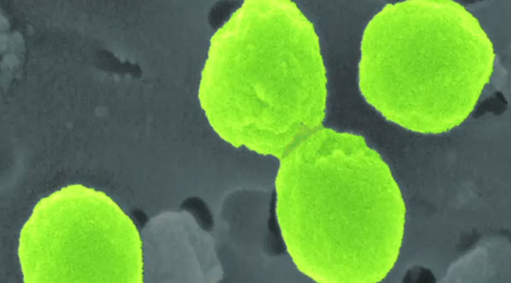 Prochlorococcus